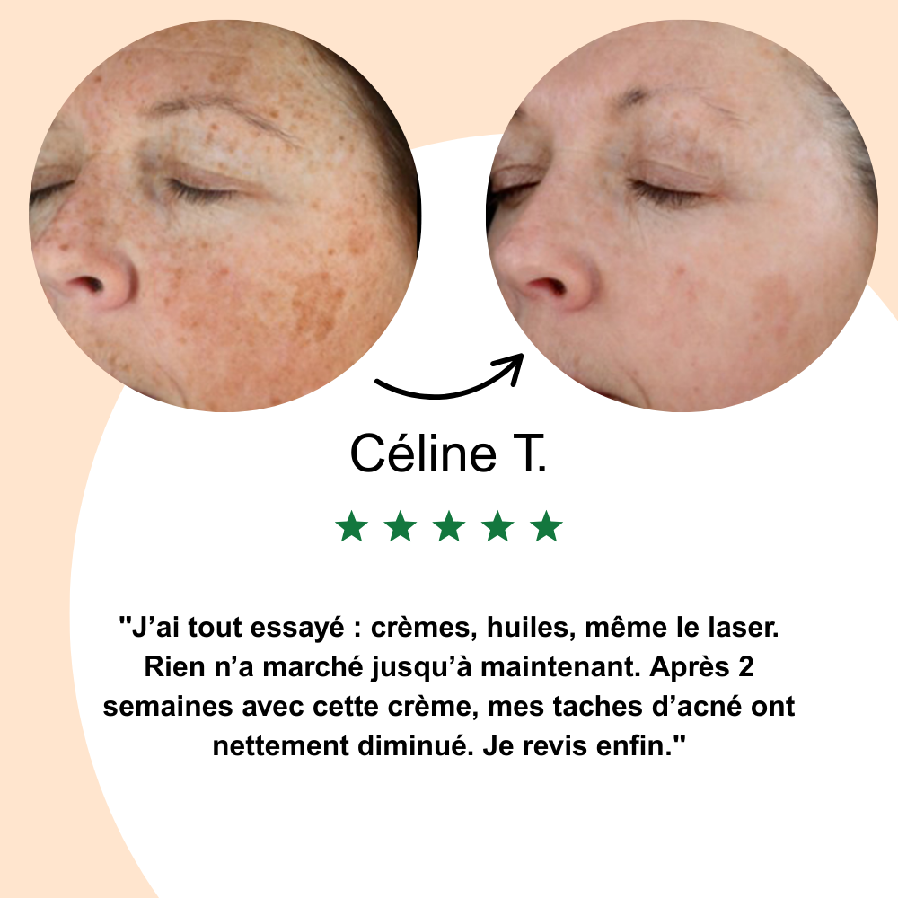 Nalya - Crème Anti-Taches Coréenne