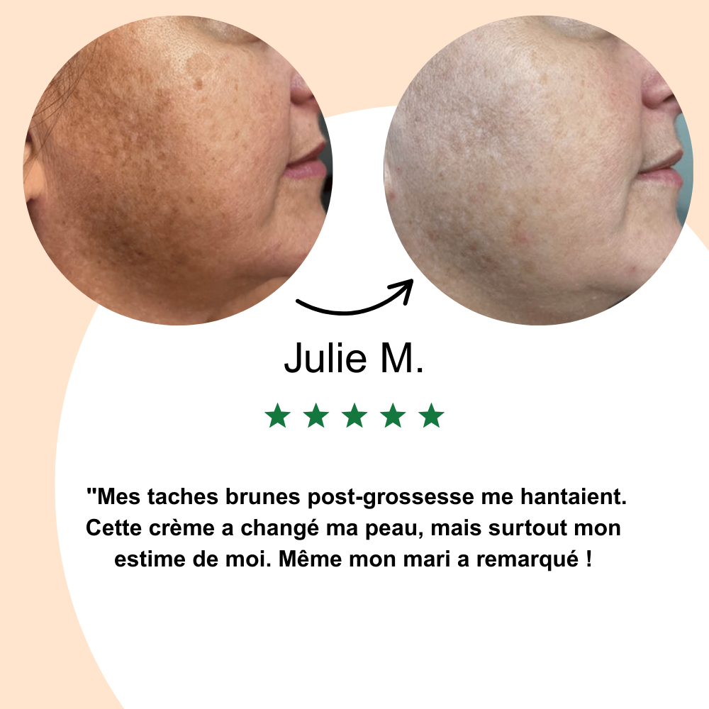 Nalya - Crème Anti-Taches Coréenne