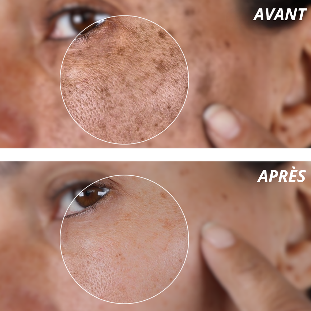 Nalya - Crème Anti-Taches Coréenne